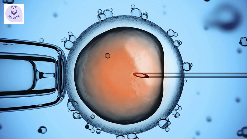 Những điều bạn nên biết trước khi thực hiện IVF