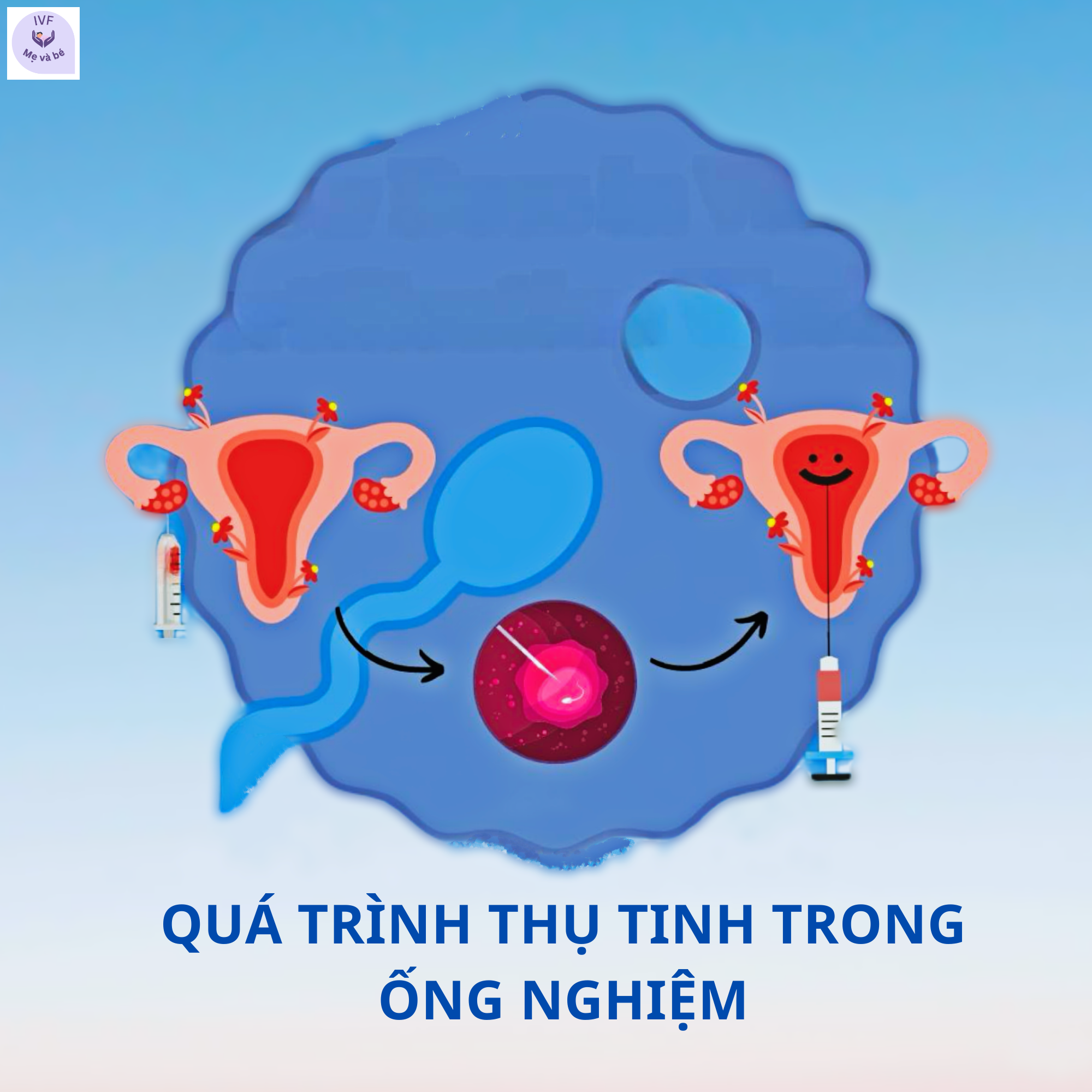 Quá trình thụ tinh trong ống nghiệm diễn ra như thế nào?
