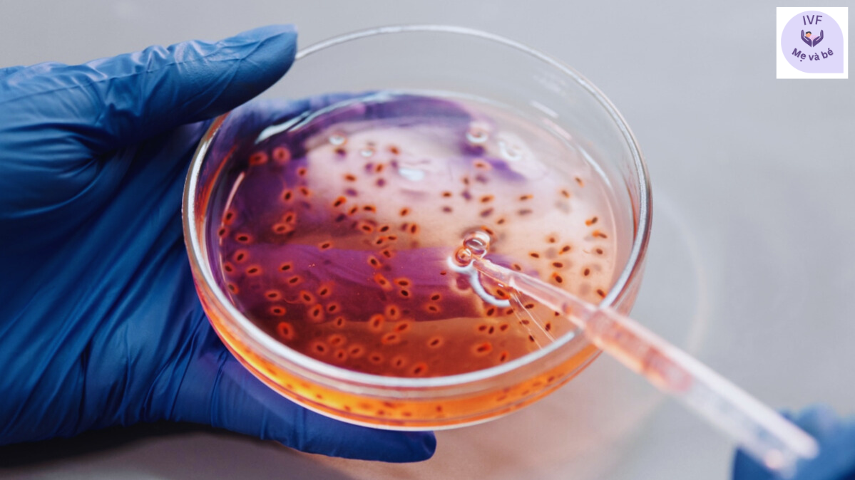 Kiểm tra chỉ số phân mảnh DNA tinh trùng (DFI)