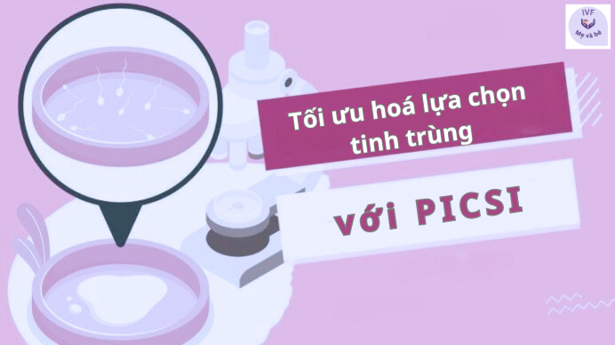 PICSI tối ưu hoá lựa chọn tinh trùng cho thụ tinh ống nghiệm